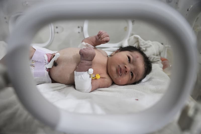 La 'niña milagro' , en el hospital de Afrin, en Siria