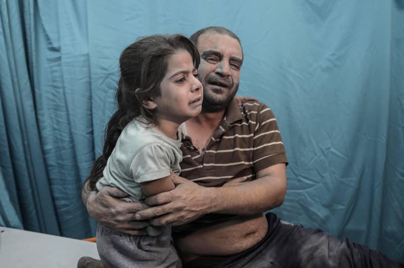 Un padre y una hija palestina que han sufrido el bombardeo en el hospital